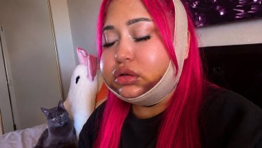 IM GETTING JAW SURGERY! (& IM SCARED) PART 1