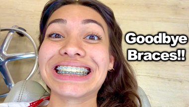 Getting Her BRACES OFF!!