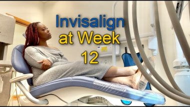 Invisalign Week 12 Appointment