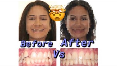 GOT MY BRACES OFF!Vlog|Gabriela Aguilar