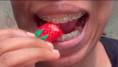 HOW I EAT SWEETS WITH BRACES