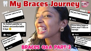 😬 Braces Q&A Part 2 || Pain, Cost, looks, Eating All About Braces Journey Struggle 😣🦷#bracesjourney