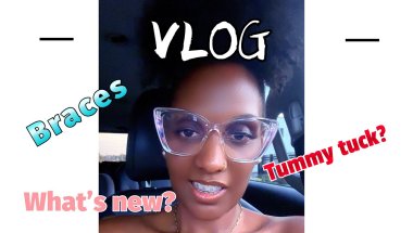 VLOG~MY BRACES EXPERIENCE~TUMMY TUCK CONSULTATION