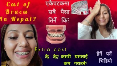 Teeth braces price in Nepal | Metal Braces Price, Hidden Charges & Smart Saving Tips.Braces journey