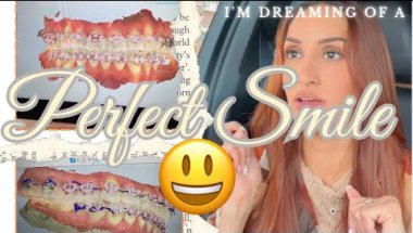 BRACES FAIL | UPDATE | REMOVAL FAIL # 3 😪