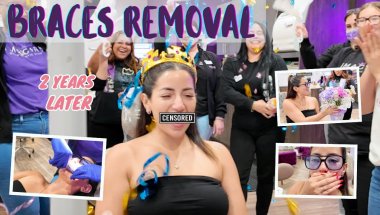 Wait Until You See My Smile… 😱 (BRACES REMOVAL VLOG)