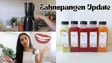 ZAHNSPANGEN UPDATE + Entsafter unboxen und austesten