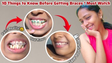 😨🦷 Top 10 Tips Before Getting Braces || My Braces experience Cost, pain, Braces Hurt, Smile Result