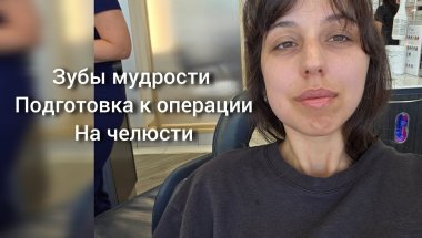 Подготовка к двучелюстной остеотомии/ортогностической операции. Удаление зубов мудрости. Влог.