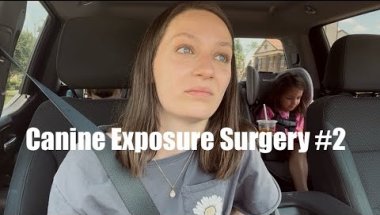 Re-Exposing & Fixing Everything During My Braces Journey