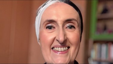 Mi preparo con voi e vi aggiorno su tutto: Invisalign, morso del ragno 🕸️ ecc