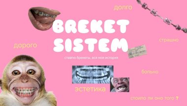 ставлю брекеты / отвечаю на все вопросы / приятного просмотра 🐽