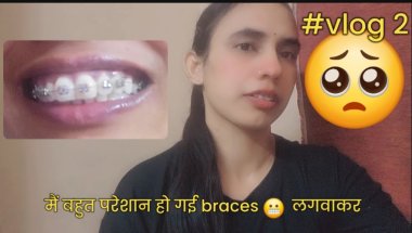 मैं बहुत परेशान हो गई braces 😬 लगवाकर || vlog #viralvideo #trending #viral #sad #emotional #explore