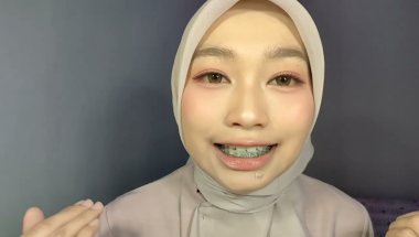 kontrol behel ke- terakhir| mau lepas behel tapi gigi masih miring?