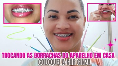 TROCANDO AS BORRACHAS DO MEU APARELHO ORTODÔNTICO EM CASA COLOQUEI A COR CINZA 🩶