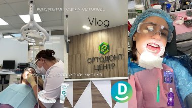 МНЕ СНЯЛИ БРЕКЕТЫ! мой опыт, я в шоке как изменилась моя внешность.