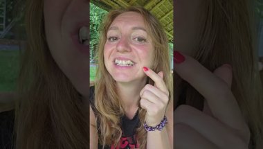 Épisode #3 Mes impressions sans filtre après la pose des aligneurs invisalign.*jour 2
