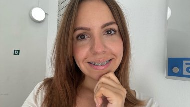 New Top Wire To Fix My Overbite | Bright Colours | Adult Braces Journey