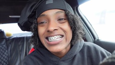 COME WITH ME TO GET BRACES *mini vlog :)