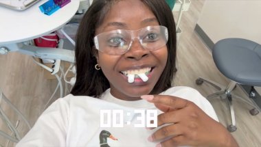 I Had Braces For 26 Months & THIS Is What Happened