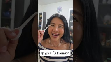 รีวิวจัดฟันใส Invisalign วิธีถอดฟันใส