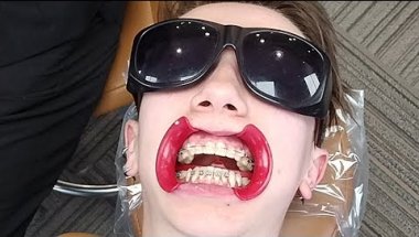 The waking nightmare that is a #dentistappointment