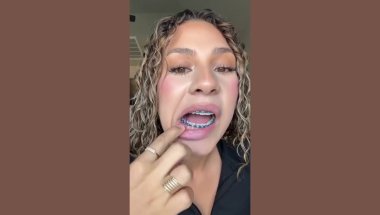 Por esta razón me arrepiento de haberme puesto brackets.🥺😩