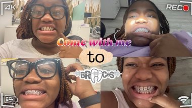 I can't believe how painful braces are