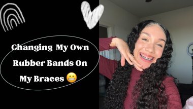 Changing My Own Braces Color #bracescolors