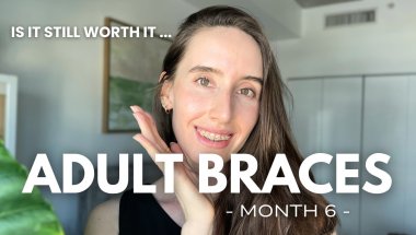 Adult Braces 101: The Brutal Truth 6 Months In & it's Not What I Expected..