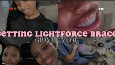 Getting My LIGHTFORCE BRACES On!
