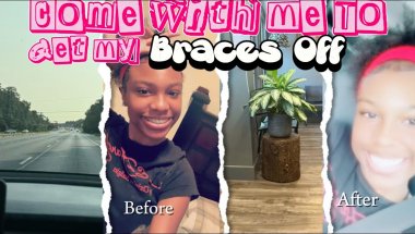 🎉 I Finally Got My Braces Off!