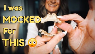 The Truth About My Braces 😳 & What a Rude Mod Said to Me