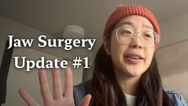 Jaw Surgery Relapse Part 1 | Getting Braces Again at 30!