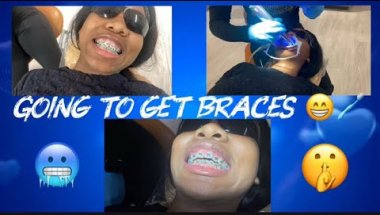 COME GET BRACES WITH ME