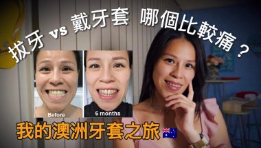 拔牙 vs 戴牙套：哪個比較痛？ 😖 | 我的澳洲牙套之旅 🇦🇺