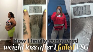 Life after failed VSG | Weight loss Journey
