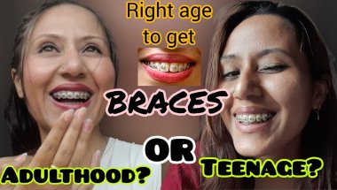 Right Time to Get Braces:Teenage vs Adult? #viral #mybracesjourney #trending #youtube #bracesjourney