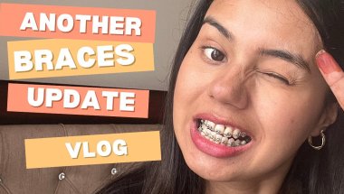 Another Braces Update 😬 | Cost, Progress & My Honest Experience