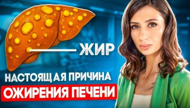 3 СТАДИИ и 3 ПРИЧИНЫ жирового гепатоза печени, о которых ВАЖНО знать всем