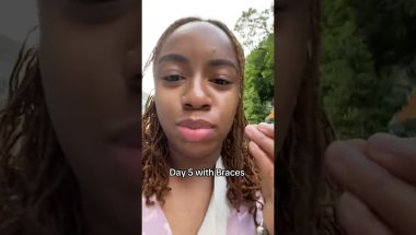 5 Days with Braces as an Adult | Tommie Marie