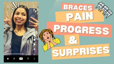 What happens within 30 days of getting braces | Real talk with @anamiika-yadavvv