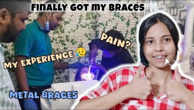 “Finally Got My Braces 😬🩶Day 1 Experience"| painful or not?😬