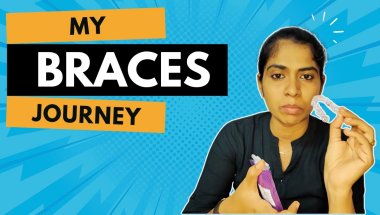 "The Real Reason Behind My Braces Journey"