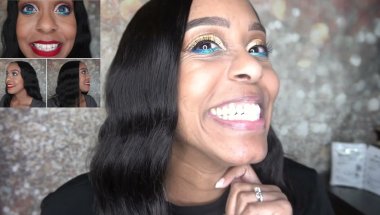 PART 14: INVISALIGN JOURNEY | TRAY 1 OF MY REFINEMENTS #invisalign #refinements