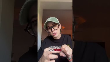 Mi-am pus aparat dentar🦷🪥
