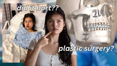 What No One Tells You About Jaw Surgery