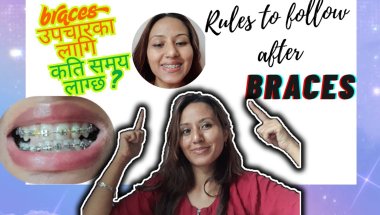 Braces Journey Guide | Duration + Important Rules #mybracesjourney #bracestransformation #braces
