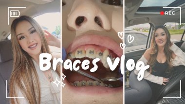 Braces Vlog Ep.11: Come with me to my ortho visit + new updates on my teeth🤍