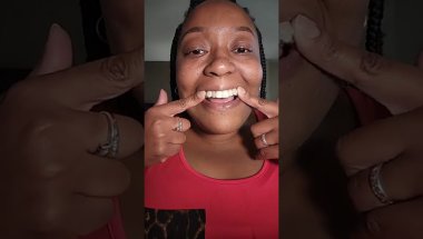 Finally got my Invisalign check this out #Queencurvy614